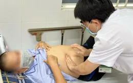Hay ăn rau muống sống, người đàn ông mang trong mình ổ sán lá gan lớn