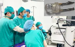 Gắp bóng đèn trong đường thở bé 10 tháng tuổi