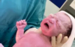 2 em bé chào đời cùng… vòng tránh thai của mẹ