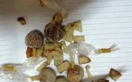 Bé 22 tháng tuổi nguy kịch do ăn phải bả chó