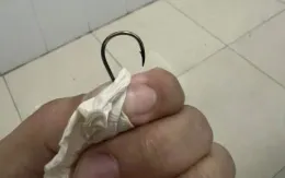 Lấy thành công lưỡi câu trong ổ bụng bé 16 tháng tuổi