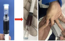 2 bệnh viện kịp thời chia sẻ thuốc cấp cứu quý hiếm cứu sống người bệnh bị ngộ độc nặng