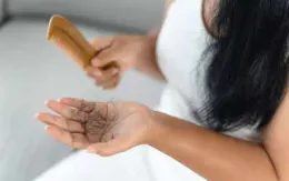 Rụng tóc nhiều và những điều cần biết