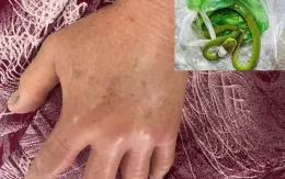 Hai người bị rắn lục đuôi đỏ cắn khi đang làm vườn
