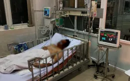 Nam thanh niên sốc sốt xuất huyết nặng sau 4 ngày tự điều trị tại nhà