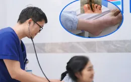 Cảnh báo gia tăng số lượng người bệnh bị rết cắn