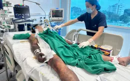 Đầu tháng ăn tiết canh lấy may, nam thanh niên nhiễm liên cầu lợn nguy kịch