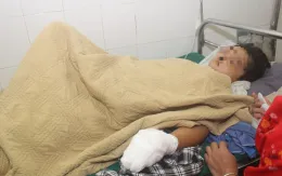 Bé trai bị dập nát bàn tay trái khi sử dụng điện thoại đang sạc pin