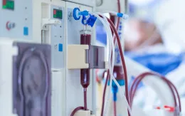 Biến chứng tim mạch trong lọc máu: Thách thức trong chẩn đoán và điều trị