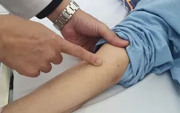Nhiễm não mô cầu có thể tử vong trong 24 giờ
