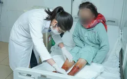 Ngâm chân giữ ấm bằng bột lá, người phụ nữ bị hoại tử hai bàn chân nghiêm trọng
