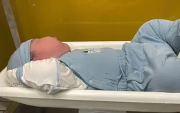 Mổ lấy thai nhi nặng 5kg cho sản phụ mắc đái đái tháo đường thai kỳ