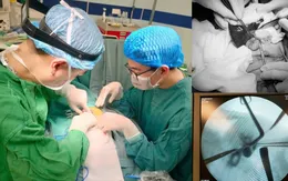 Phẫu thuật teo mật bẩm sinh cho bé gái 1 tháng tuổi