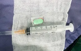 Nhập viện vì thói quen uống một lúc nhiều viên thuốc