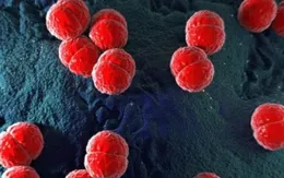 Phát hiện ổ dịch viêm não mô cầu tại tỉnh Thái Bình