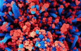 Nga lên tiếng về loại virus chưa xác định gây ra tình trạng sốt và ho ra máu