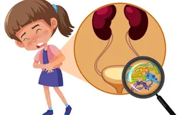 Không chủ quan với nhiễm khuẩn tiết niệu tái phát