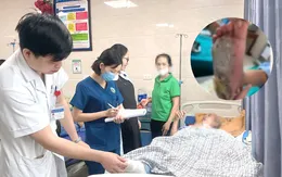 Bỏng độ III, nhiễm trùng gan bàn chân vì chườm nóng