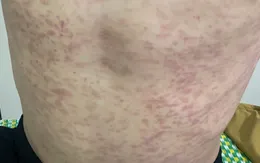 Hải Dương chủ động ứng phó với dịch bệnh truyền nhiễm