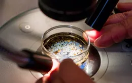 Lần đầu tiên phát hiện vi nhựa trong dịch nang buồng trứng của con người