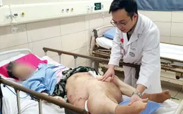 U xơ thần kinh gây biến dạng chân: Cảnh báo từ ca bệnh bỏ điều trị giữa chừng