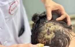 Hai người ở Hà Nội bị chó nhà cắn nhập viện