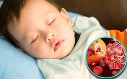 Cảnh báo từ WHO: Thiếu sắt ở trẻ dưới 2 tuổi gây ảnh hưởng không hồi phục đến não bộ
