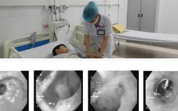 Cảnh báo: Xuất huyết tiêu hoá - bệnh không còn của riêng người lớn