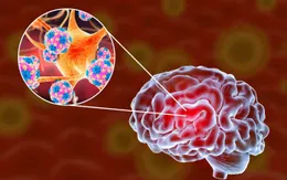 Cảnh báo viêm não virus mùa hè: Trẻ nhỏ và người cao tuổi cần đặc biệt đề phòng