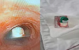 Hóc vỏ thuốc chưa bóc: Cảnh báo tai nạn đường thở nguy hiểm