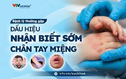 Dấu hiệu nhận biết bệnh tay chân miệng - Ba mẹ cần biết!