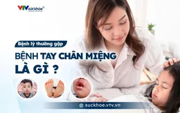 Bệnh tay chân miệng là gì?
