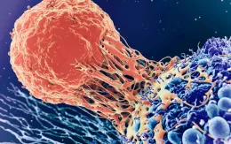 Những bước tiến mới trong điều trị bệnh ung thư