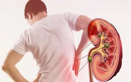 Thận tổn thương nghiêm trọng sau 16 năm sống chung với bệnh nền