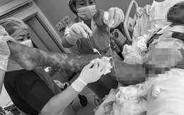 Thoát chết ngoạn mục sau khi bị hoại tử da đến 92% cơ thể do phản ứng thuốc hiếm gặp