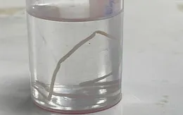 Bệnh giun rồng tái xuất tại Yên Bái: 16 ca mắc, nhiều ca do ăn gỏi cá và uống nước suối