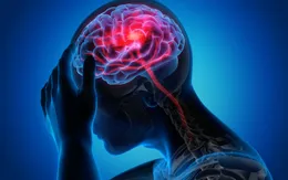 48 giờ 2 lần đột quỵ: 1 hành trình sống sót kỳ tích