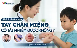 Tay chân miệng có tái nhiễm không?