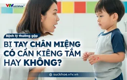 Bị tay chân miệng có cần kiêng tắm không?