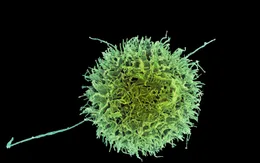 Phát hiện mới mở hướng đi cho cuộc chiến chống ung thư