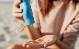 Bỏng nắng mùa hè: Đừng để kỳ nghỉ hóa tai nạn da liễu