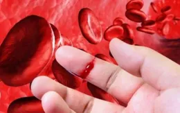 Rối loạn đông máu hiểm họa thầm lặng có thể kiểm soát