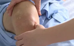 Thoái hóa khớp gối: Hiểu đúng để phòng tránh và điều trị kịp thời
