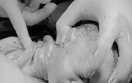 An toàn mẹ tròn con vuông dù bé quấn 4 vòng dây rốn
