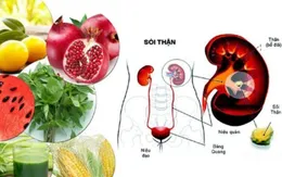 Bệnh nhân sỏi thận nên ăn gì?