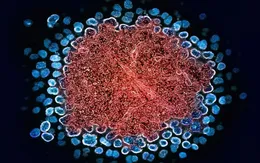 Thái Lan báo động gia tăng ca nhiễm HIV trong giới trẻ