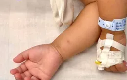 Nguy hiểm rình rập: Bé gái suýt ngộ độc vì uống nhầm thuốc diệt nấm