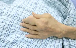 Biến chứng nguy kịch vì tự điều trị gout sai cách