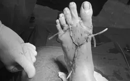 Cảnh báo gia tăng tai nạn lao động nghiêm trọng