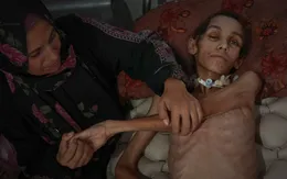 Tây Ban Nha tiếp nhận trẻ em Palestine điều trị y tế khẩn cấp